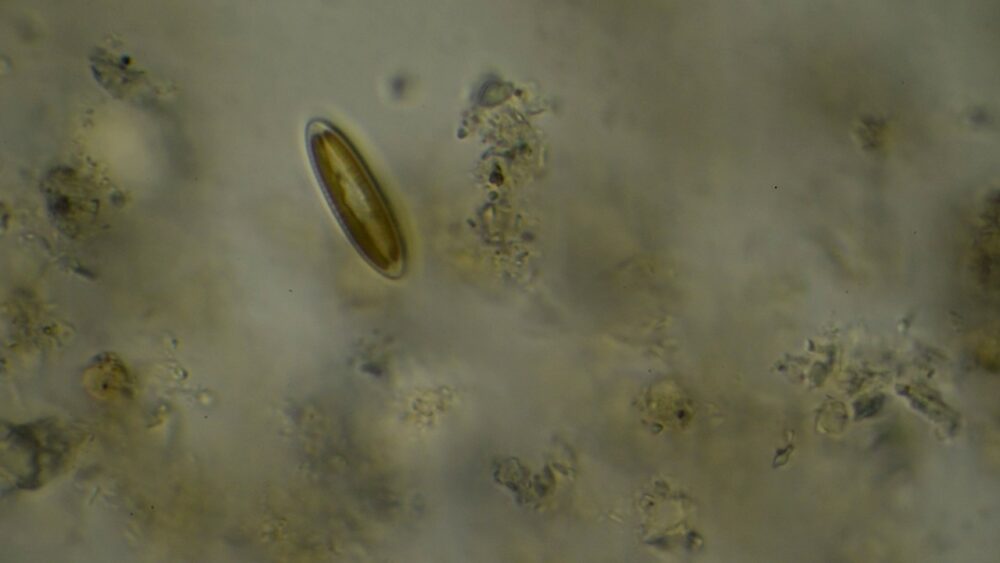 An image of some green cells under a microscope.